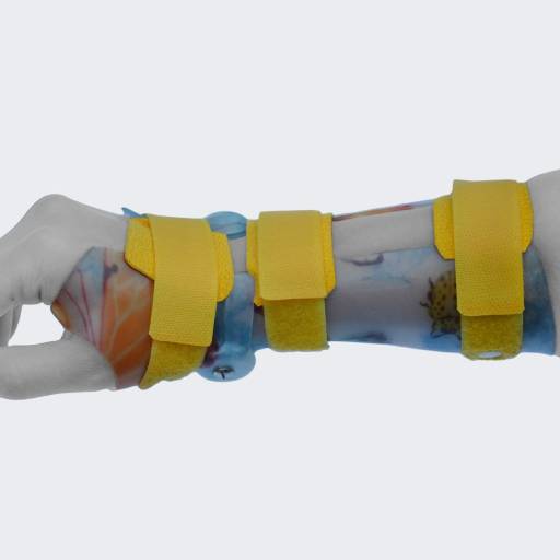 AFH DTM-Orthese am Handgelenk in seitlicher Ansicht